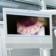 Intraoral Cameras