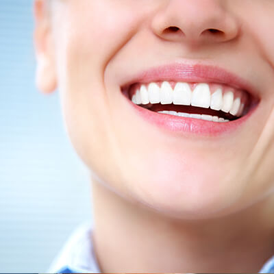 A woman flaunting her natural-looking set of implant-supported dentures.