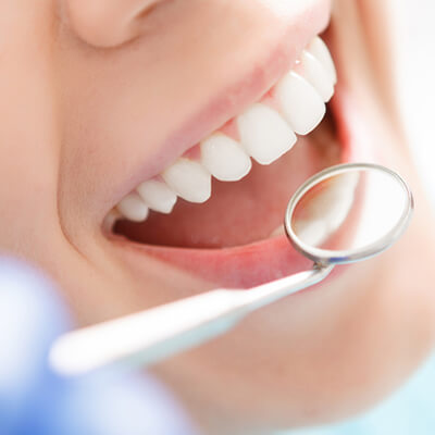 A dentist's hands holding a model of dentures