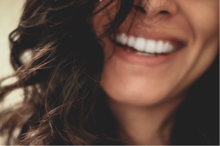 woman's whie smile from porcelain veneers